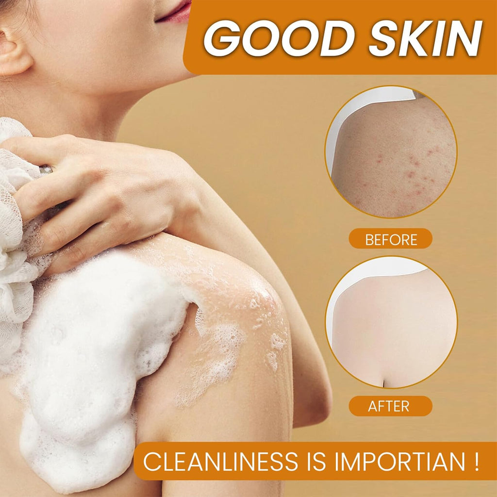 2PC 100G Savon Au Curcuma Pour Éclaircir La Peau, Turmeric Kojic Acid Éclaircissant Pour Le Visage, Doux Et Hydratant Pour Tous Les Types De Peau Soap-4