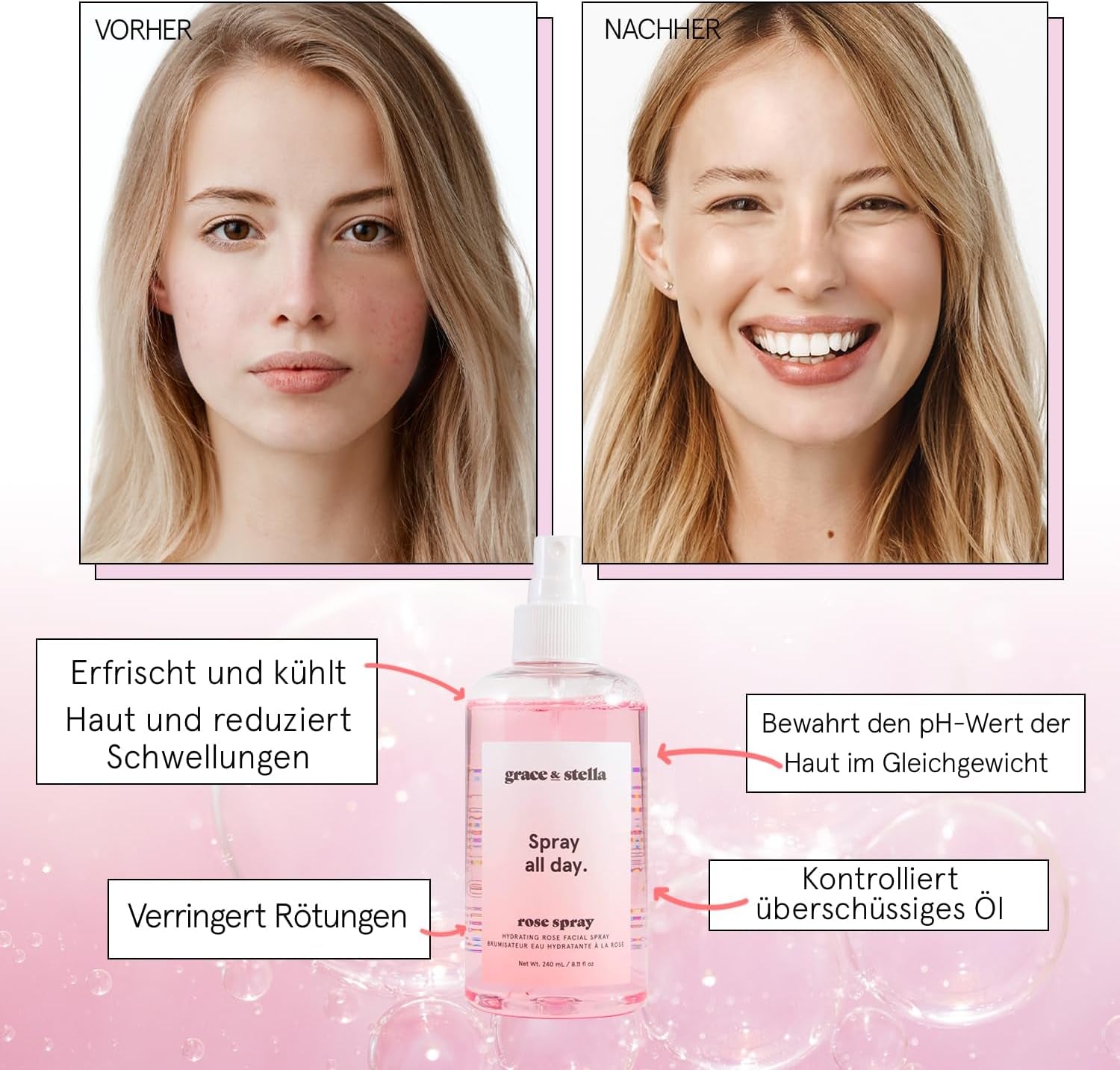 - Spray Eau De Rose Visage Vegan, Lauréat Du Prix D'Excellence Pour La Peau, Parfait Comme Vaporisateur Cheveux, Spray Hydratant Cheveux, Lotion Tonique Visage, Brume Corps (240Ml)